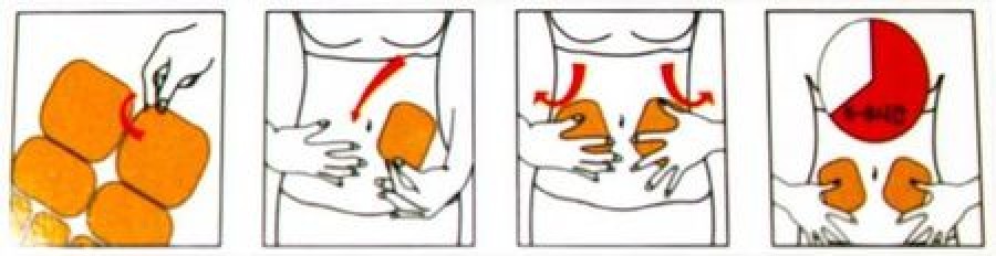 Lieknėjimo pleistrai 8vnt.